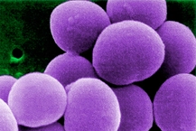 El Staphylococcus aureus, una bacteria que indica mala manipulación en cocina