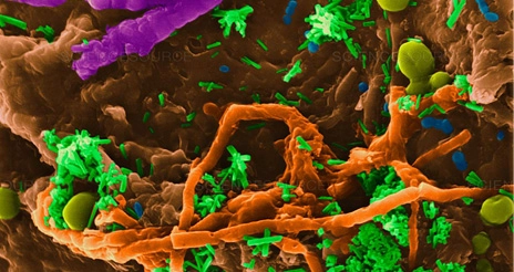 ‘Las bayetas pueden acumular seis veces más bacterias que el botón de la cadena del váter’